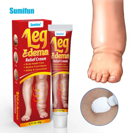 New Natural Anti Edema Cream Remove Arm Leg Swelling Pain Relief Ointment
